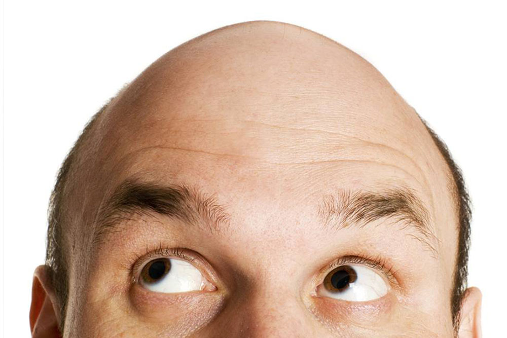 Calvice Gleice Legati - Calvice